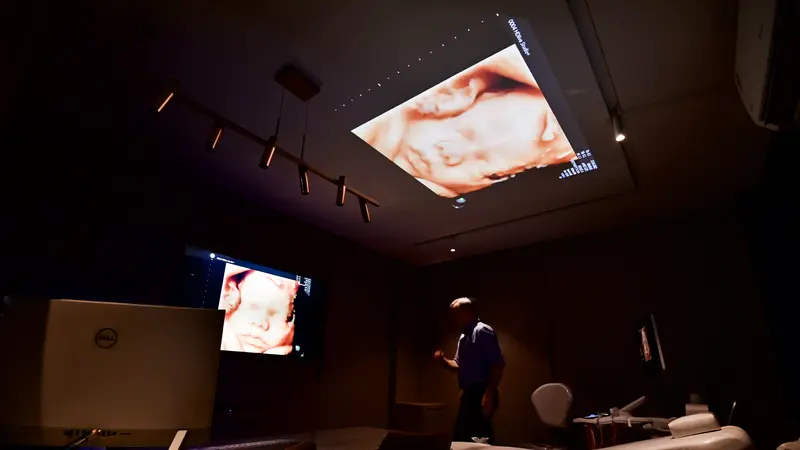 Sala de exame no escuro com a imagem 3D do rosto do bebê projetada no teto e no monitor da parede